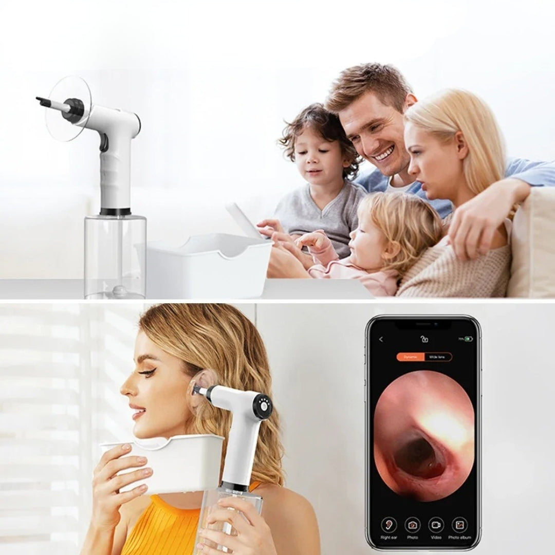 ClearCanal™ - Ear Cleaner Kit