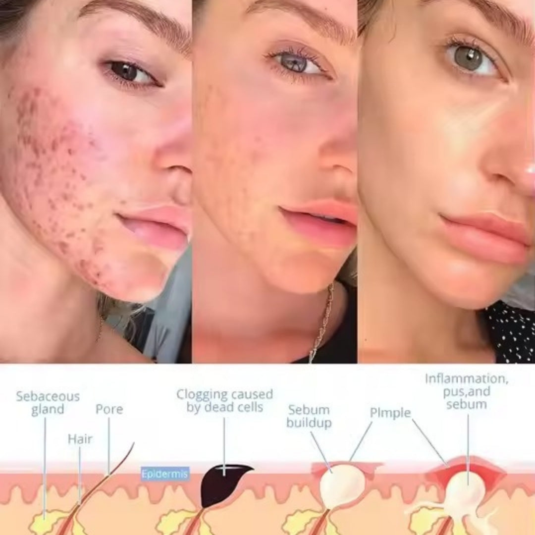 SkinPulse™ - Facial Wand