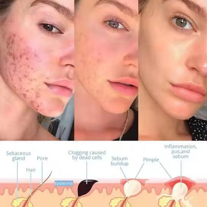 SkinPulse™ - Facial Wand